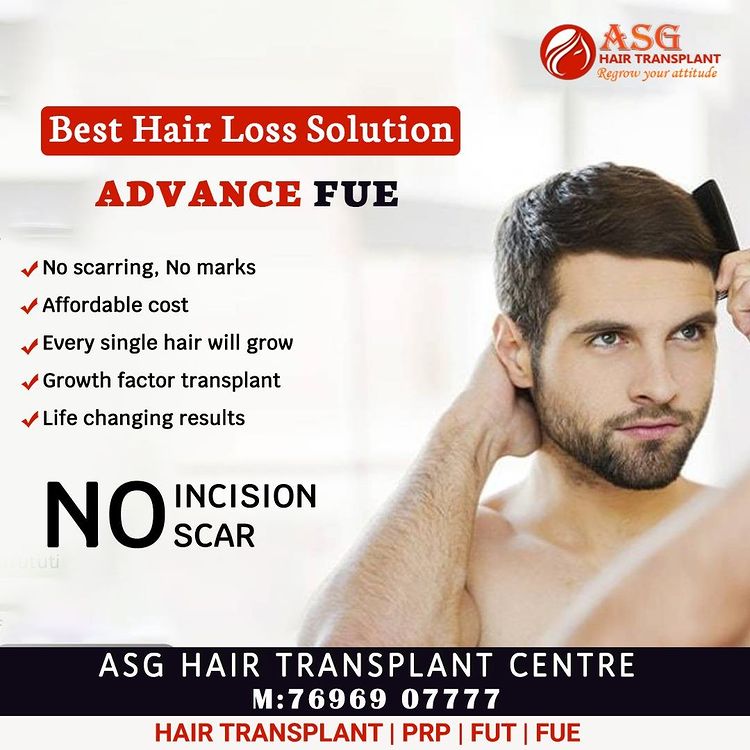 ASG Hair Transplant  Jalandhar